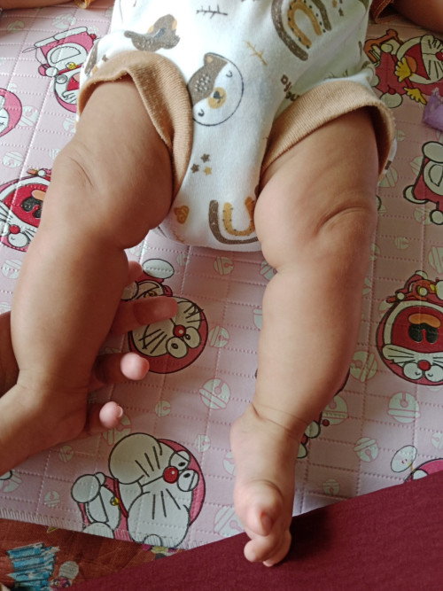 Kaki bayi kelihatan agak bengkok