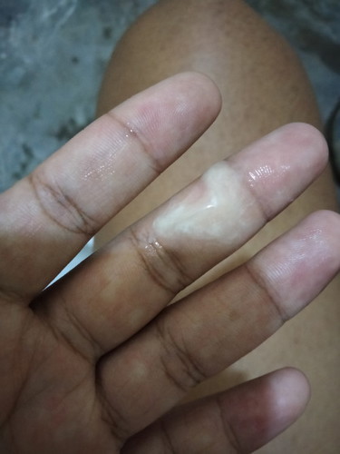 ปวดท้องใกล้ออก 37+3w