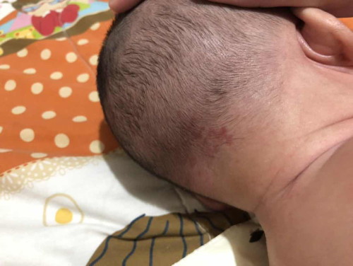 แบบนี้คืออะไรหรอคะ น้อง3เดือนค่ะ