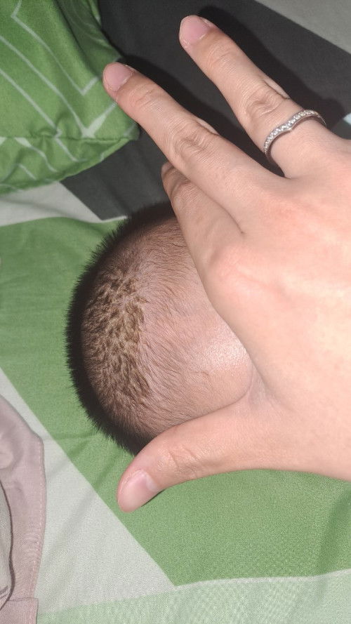 Kerak pada kepala bayik