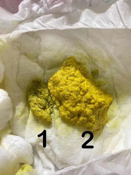 สอบถามแม่ๆทีค่ะ