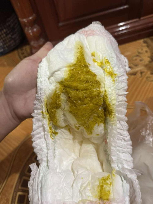 น้องอึแบบนี้ปกติมั้ยคะแม่ๆ