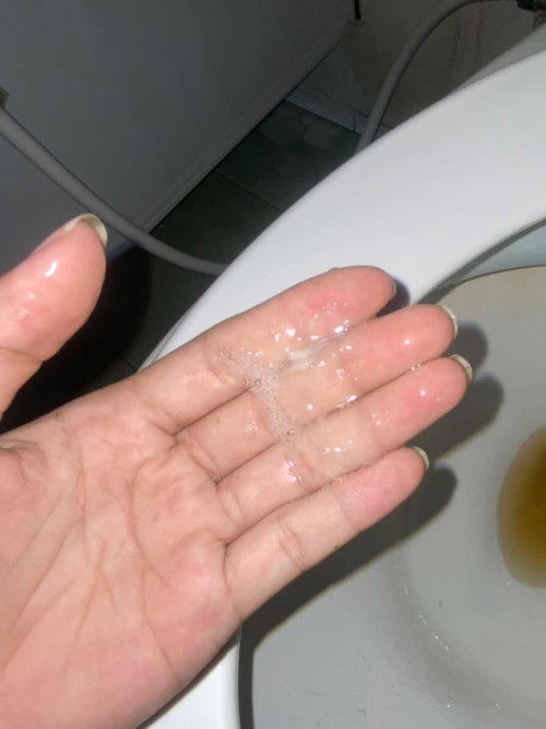 อายุครรภ์ 36+5