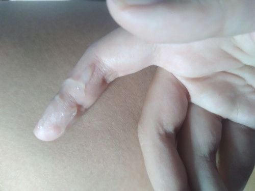 แบบนี่เรียกว่าตกขาวหรือมูกค่ะแม่ๆ