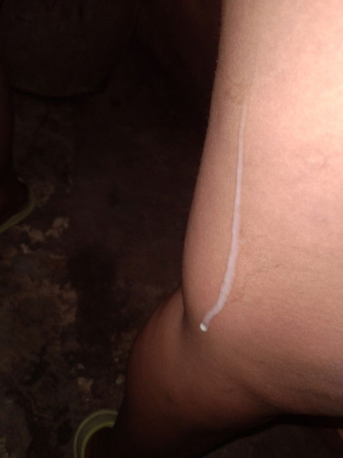 ตอนนี้38wแล้วค่ะ แบบนี้ต้องไปรพ.ไหมคะ