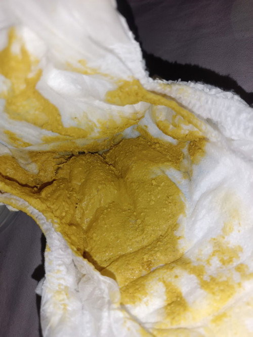 น้องอึแบบนี้ปกติไหมคะ