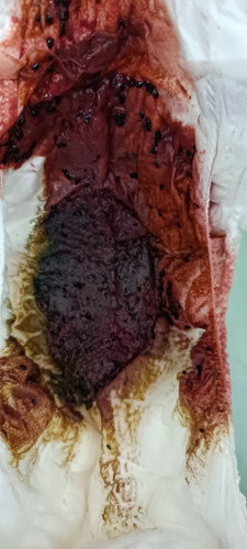 Berak warne merah ,JANGKITAN atau sebab buah naga