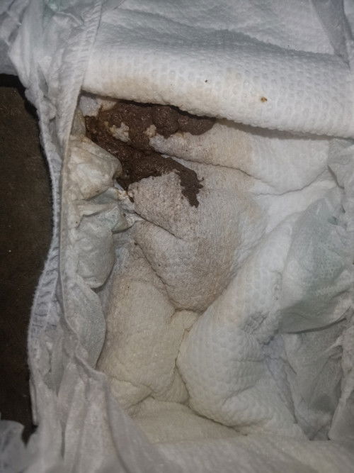 Anak cirit umur setahun