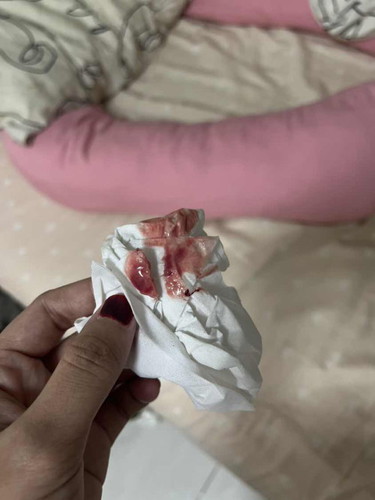 Bleeding + lendir tanda bersalin ke