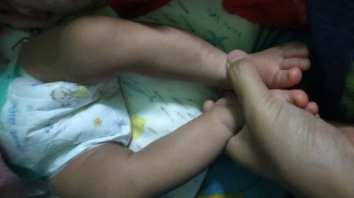 ลูกขาโก่งใช่มั้ยคะเเบบนี้