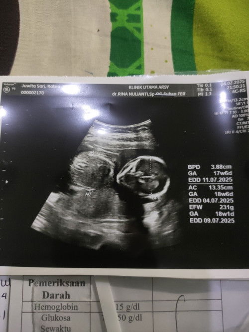 ada yang tau gak bun HPL yg benar yang mana