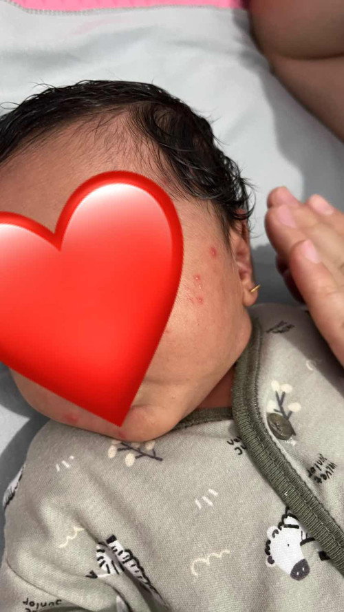 Kulit bayi