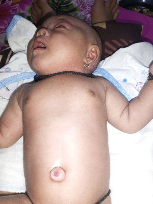 Bun bayiku jln 2bln puser blm masuk kedlm. Ad yg SM gk bun