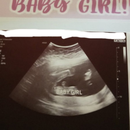 gender girl or boy?