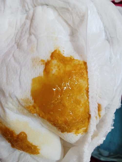 น้องได้ 1เดือน 11