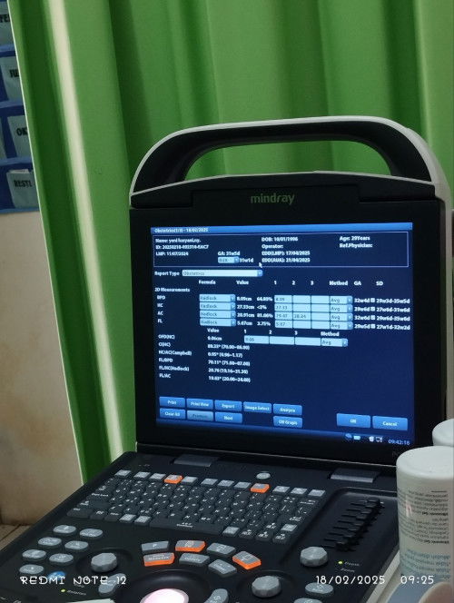 Hamil usia 32 w 
Tapi kenapa di Usg beda beda ya? Ada yang pernah mengalami ?