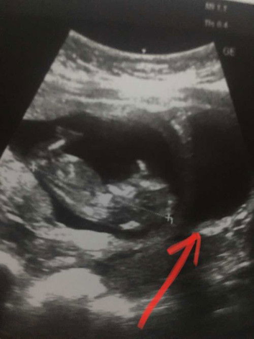 สอบถามแม่บ้านแฝดค่ะ