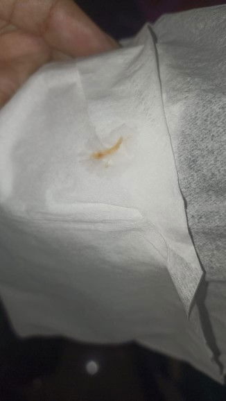 Keluar sedikit serat berwarna coklat