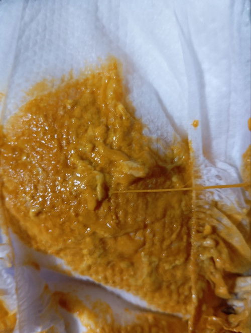 Normal BA tong poop NI baby may Ubo Siya?