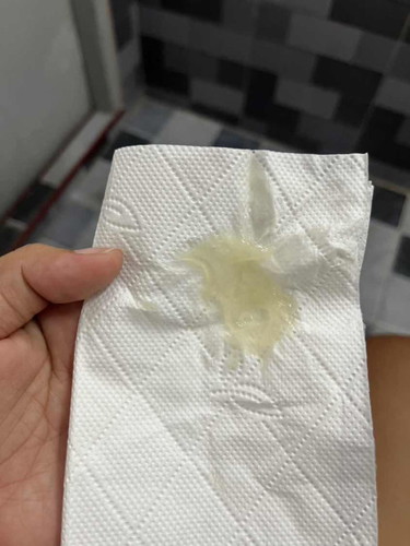 แบบนี้ใกล้คลอดรึยังคะ