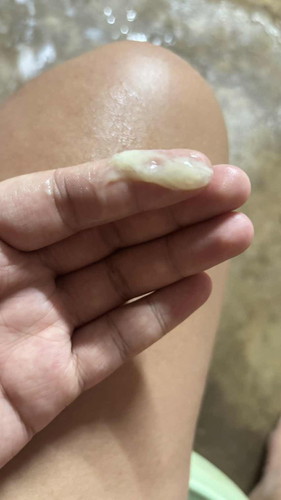 มีมูกใสออกตอน36+3วีค