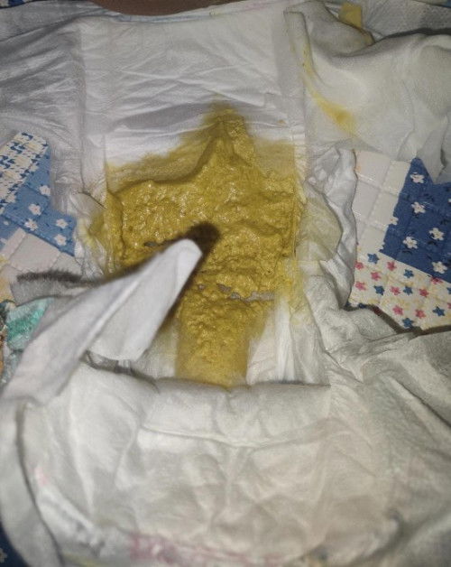 Pup bayi 1bulan agak cair