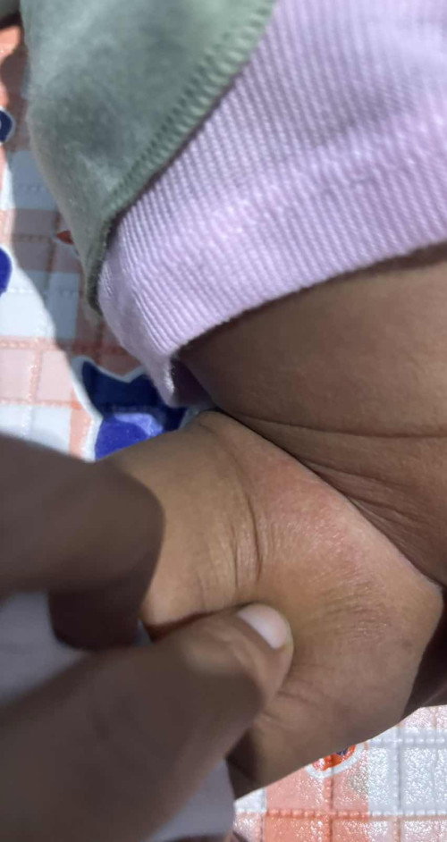 Selangkangan kering seperti bersisik gitu