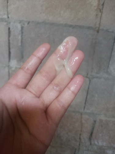 แบบนี้ผิดปกติไหมคะ