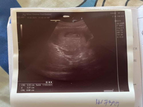 ขอสอบถามหน่อยค่ะ