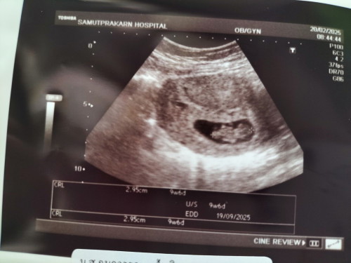 น้อง 10+5 วีค