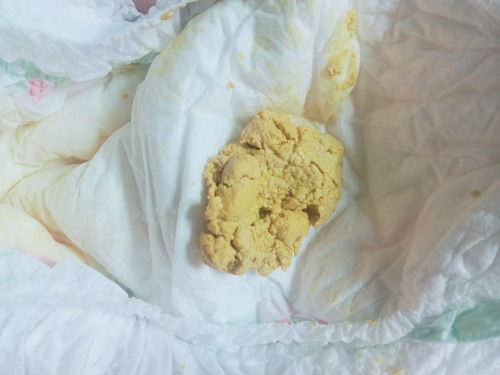 กินนมแม่กับนมผง