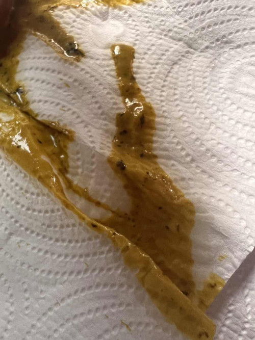 สอบถามแม่ๆค่ะ