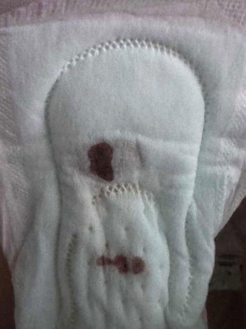 Kalo kya gini keguguran bukan ya bund?