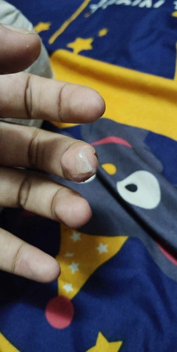 เป็นมูกแบบนี้คืออะไรคะท้องแรก