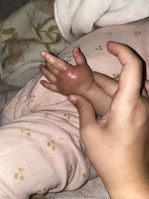 ไม่รู้น้องไปโดนอะไรกัด