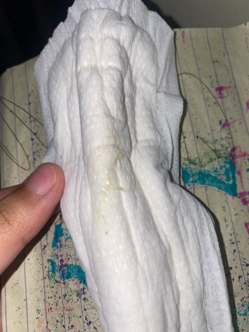 Discharge before period po ba ito?