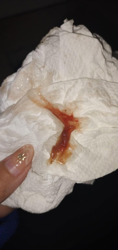 Hi just a question if implantation ba ito or miscarriage kasi after nito may spotting na or bleeding