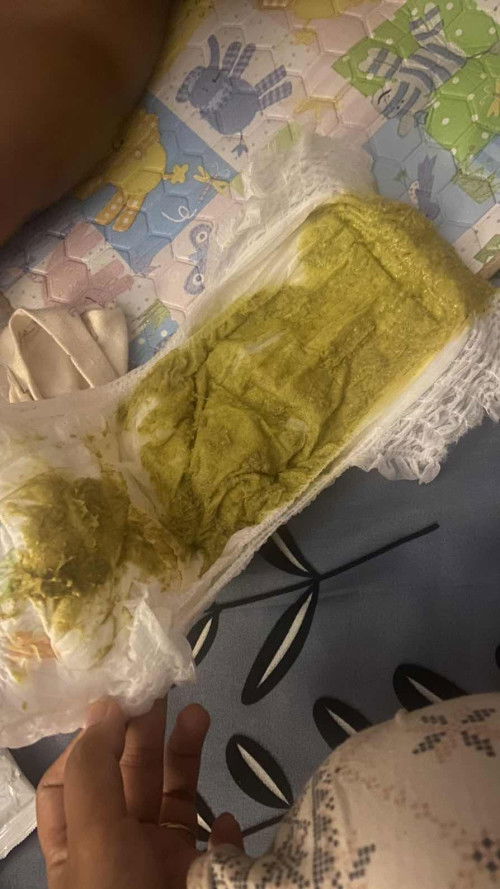 Pup bayi 7 bulan warna hijau dan banyak