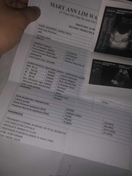 34 weeks po ako nyan that time. pero ngayon i’m currently 35 weeks and 2 days na po.