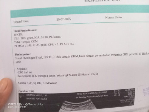Hpl 15 maret maju jadi 25 feb