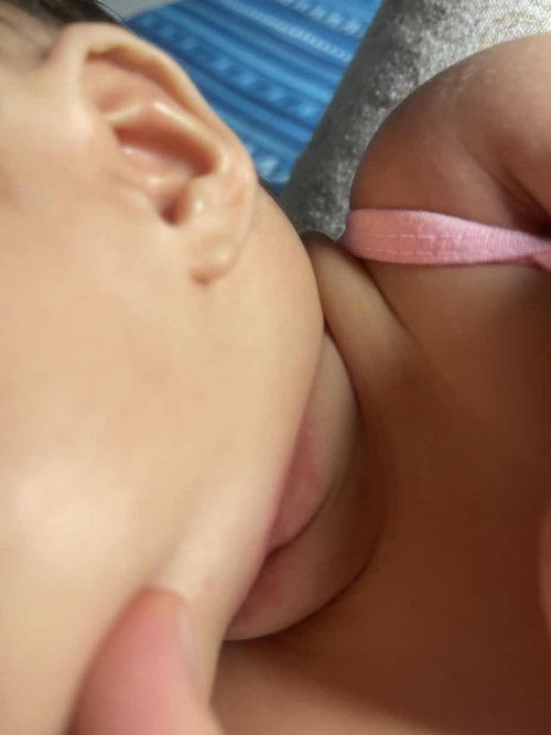 Halas sa leeg at kili kili