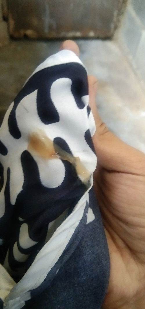 มูกใส ท้องแข็ง