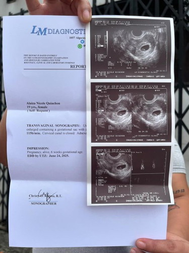 nadulas 6weeks pregnant
