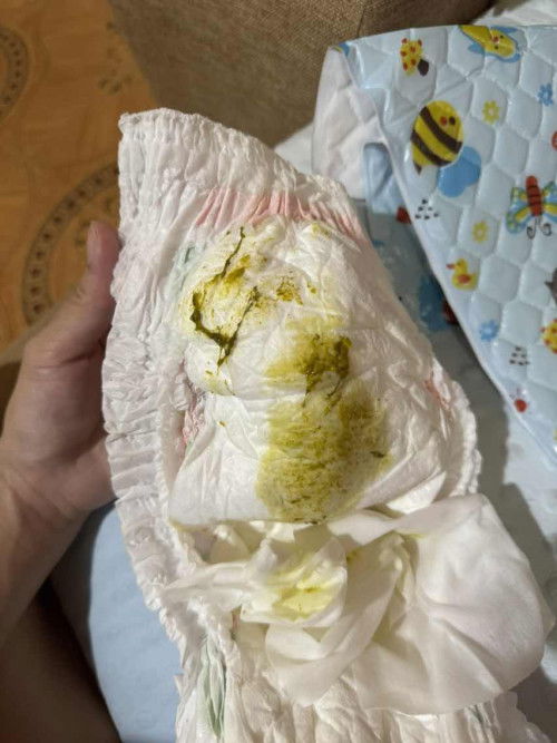 อึแบบนี้ปกติมั้ยคะ ทานนมแม่นะคะ