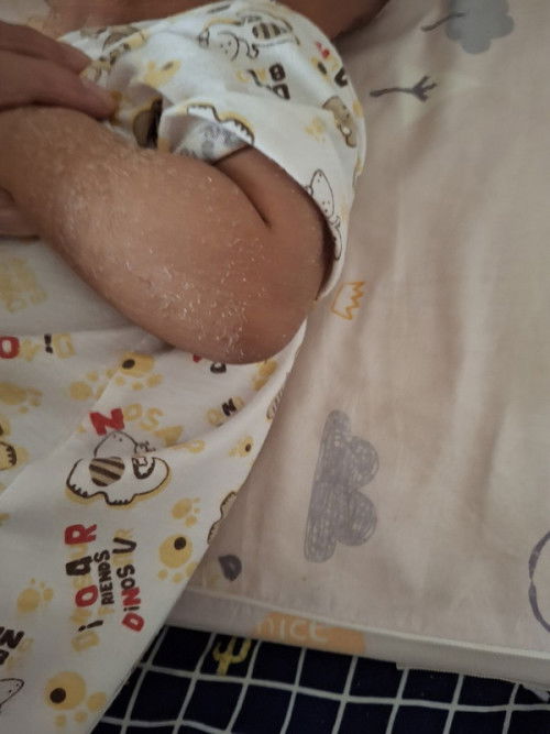 ผิวลูกลอก ปกติมั้ยคะ