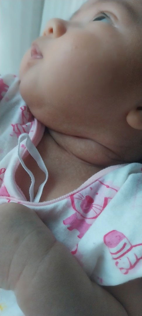 แบบนี้น้องเปนอะไรคะ