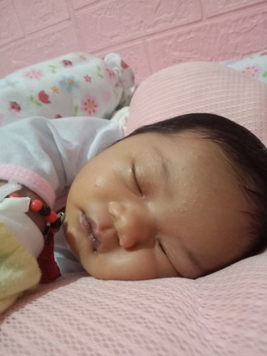 Hello mga mi 15 days old palang si baby Normal lang po ba yung color ng lips nya ?