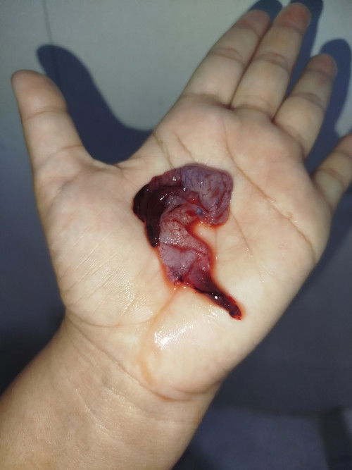 Hpht 13 Januari tespek negatif