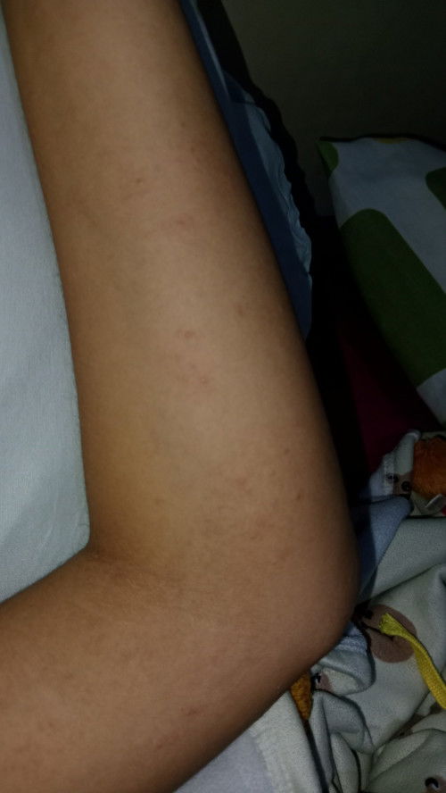 Gatel bintik sebadan