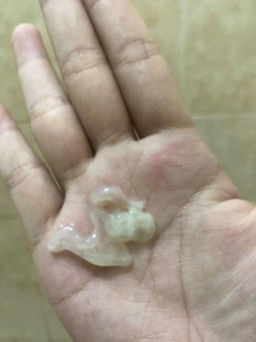 อายุครรภ์37+4week
